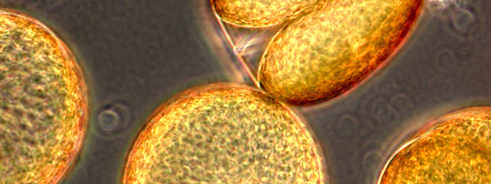 Coscinodiscus wailesii CCAP 1013/8 (courtesy of CCAP)